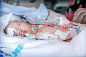 Herzkranke-Kinder-Muenster-baby-intensivstation